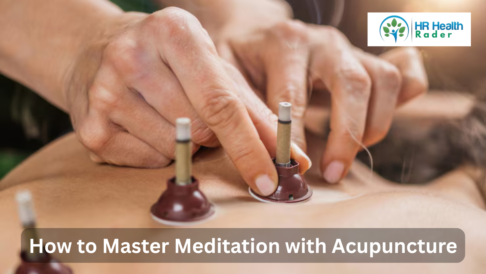 Meditation with Acupuncture