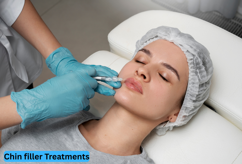 chin filler treatments