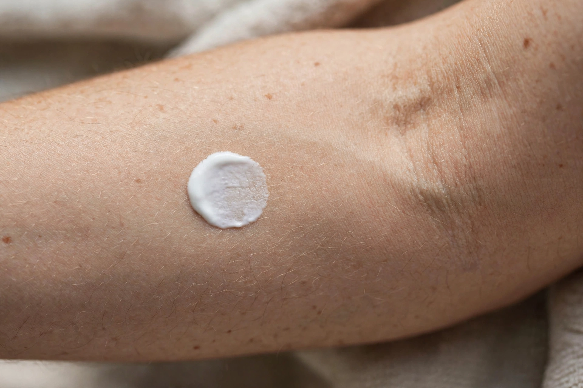 A patch test on the inner arm, a sensible first step before using any new skincare product